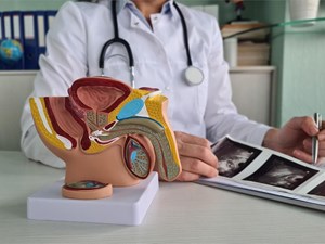 6 factores de riesgo del cáncer de próstata que quizás no conocía
