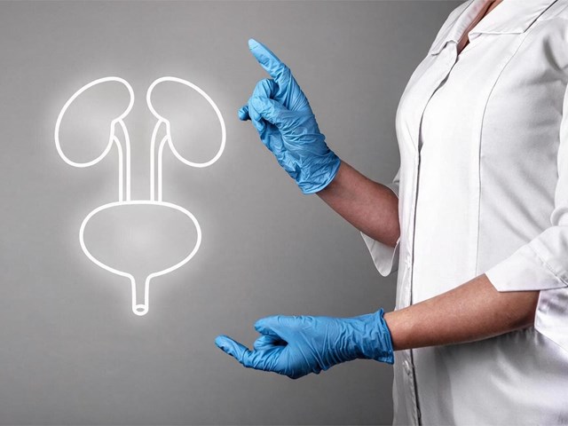 Cáncer de vejiga superficial vs músculo-invasivo: diferencias clave en el tratamiento