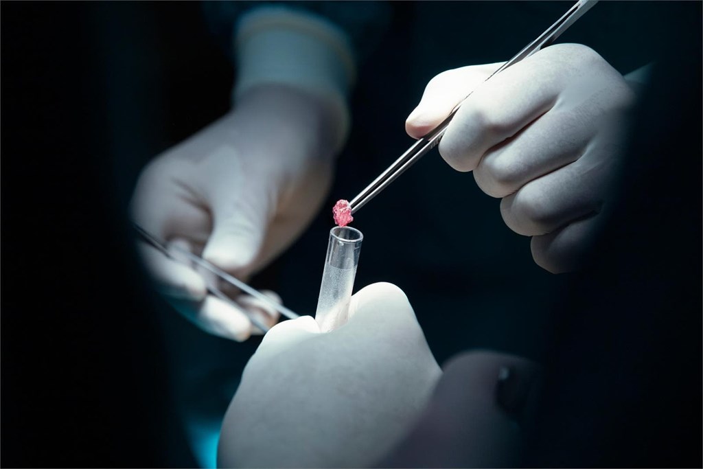 Diagnóstico del cáncer de próstata: biopsia y otras técnicas