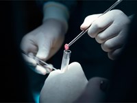 Diagnóstico del cáncer de próstata: biopsia y otras técnicas