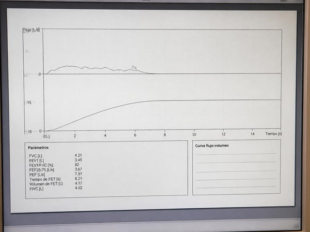 Estudio de uroflujometría en Pontevedra
