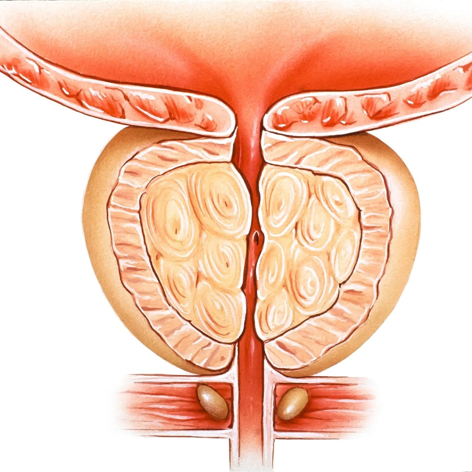 Tratamientos del Dr. Díaz Bermúdez Adenoma de próstata